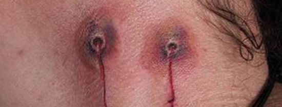 15 tatuaje ciudate pe gat 15 tatuaje ciudate pe gat