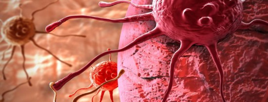 Nou medicament aflat în studiu pentru cancerul pulmonar, în România Nou medicament aflat în studiu pentru cancerul pulmonar, în România