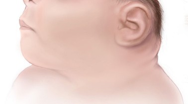 Top 10 mutaţii care sfidează definiţia a ceea ce reprezintă un om Top 10 mutaţii care sfidează definiţia a ceea ce reprezintă un om