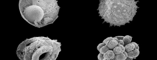 O nouă descoperire paleontologică umple un gol important în istoria vieţii şi oferă indicii cruciale cu privire la apariţia primelor organisme pluricelulare O nouă descoperire paleontologică umple un gol important în istoria vieţii şi oferă indicii cruciale cu privire la apariţia primelor organisme pluricelulare