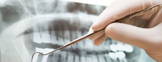 Copilul tău are nevoie de aparat dentar? Iată la ce semne ar trebui să fii atent Copilul tău are nevoie de aparat dentar? Iată la ce semne ar trebui să fii atent
