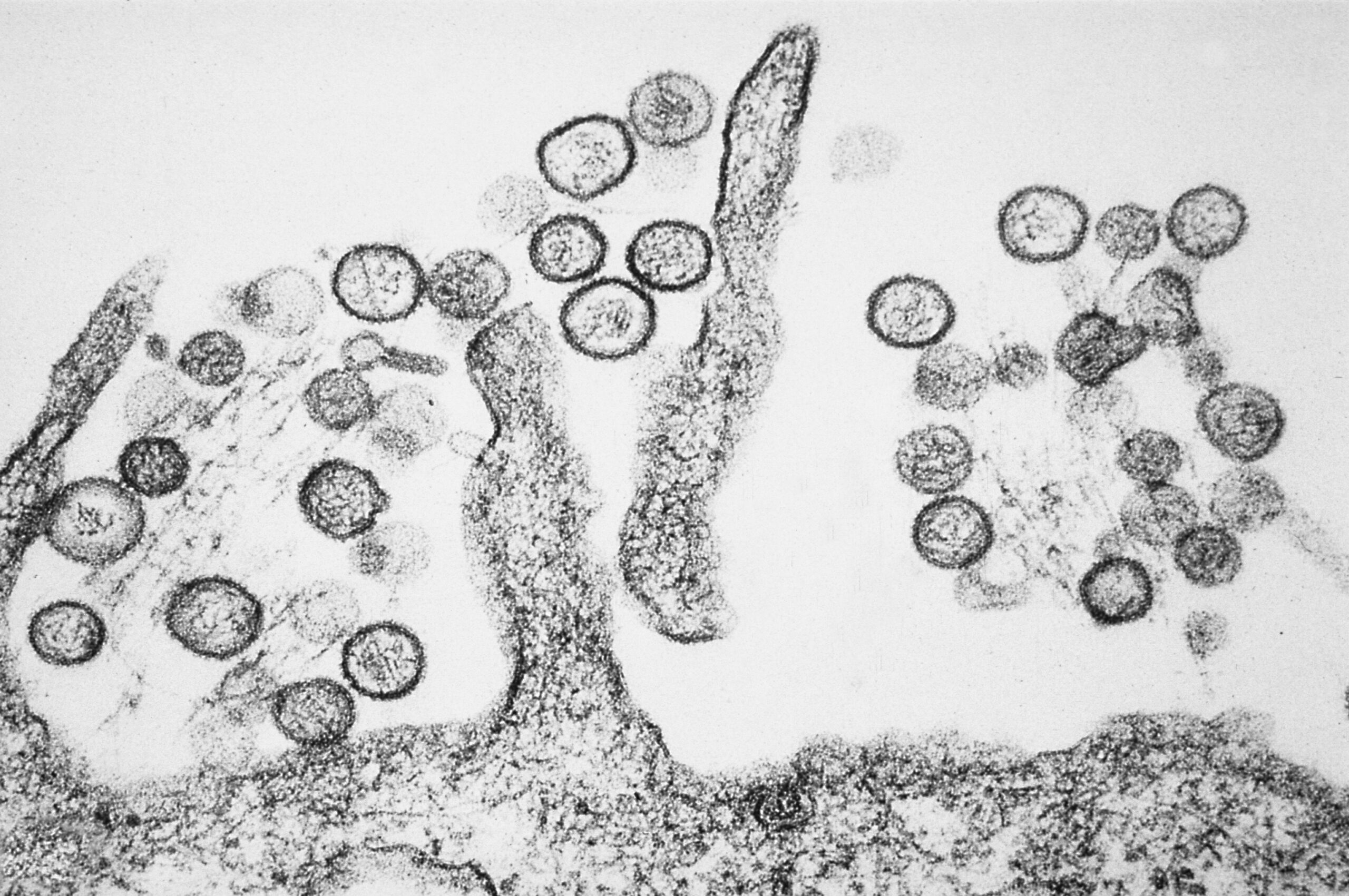 Focar mortal de hantavirus pe o ambarcațiune de croazieră din Atlantic