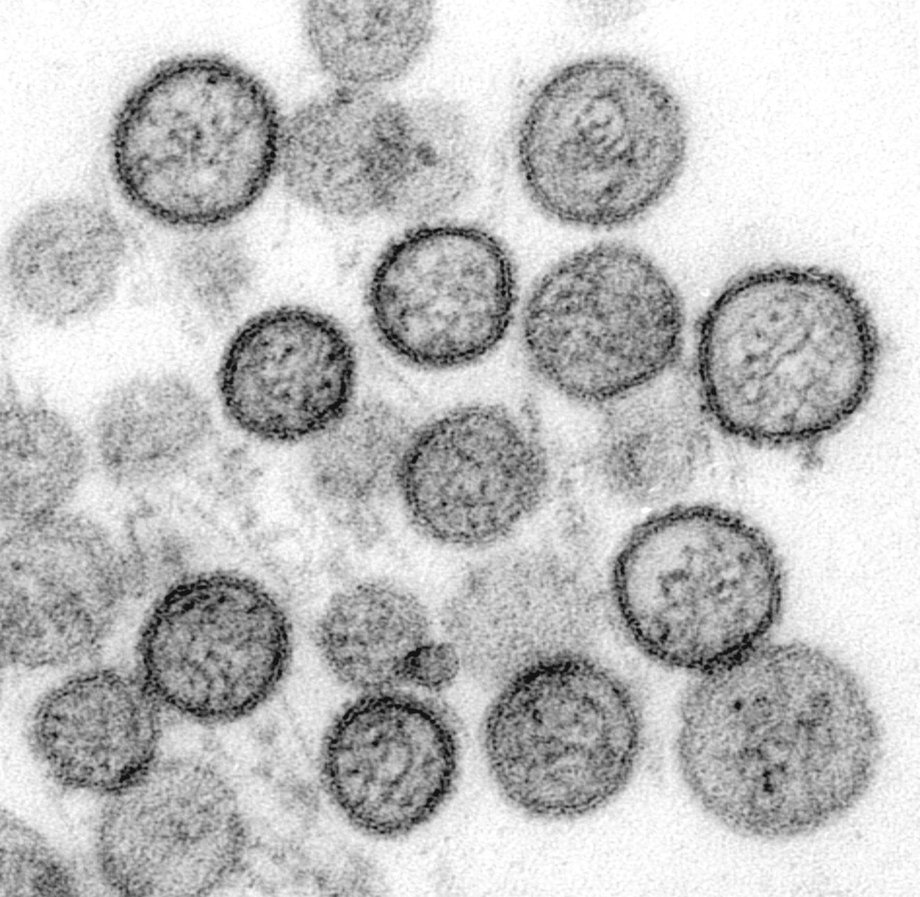 OMS susține că eruptia de hantavirus de pe nava de croazieră „nu semnalează începutul unei noi pandemii”