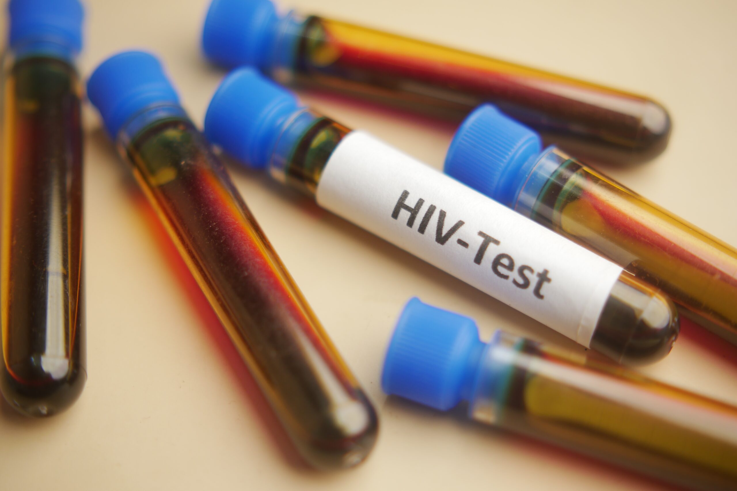 Un nou tratament ar putea păstra HIV-ul sub control timp de doi ani